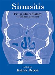 Sinusitis From Microbiology to Management 1st Edition,082472948X,9780824729486