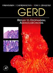 GERD Reflux to Esophageal Adenocarcinoma 1st Edition,0123694167,9780123694164