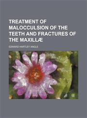 Treatment of malocculsion of the teeth and fractures of the maxillæ,1155306309,9781155306308