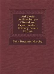 Ankylosis Arthroplasty--Clinical and Experimental - Primary Source Edition,1287935230,9781287935230