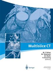 Multislice Ct,3540405909,9783540405900