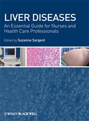 Liver Diseases An Essential Guide for Nurses and Health Care Professionals,1405163062,9781405163064