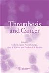 Thrombosis and Cancer 1st Edition,1841842877,9781841842875