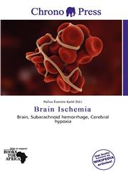 Brain Ischemia,6137129551,9786137129555