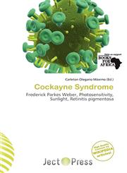 Cockayne Syndrome,6200763771,9786200763778