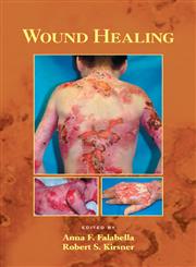 Wound Healing 1st Edition,0824754581,9780824754587