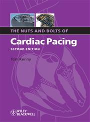 The Nuts and Bolts of Cardiac Pacing 2nd Edition,1405184035,9781405184038