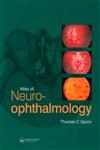 Atlas of Neuro-ophthalmology 1st Edition,1853177733,9781853177736