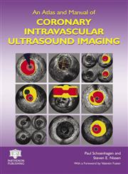 An Atlas and Manual of Coronary Intravascular Ultrasound Imaging,1842142747,9781842142745