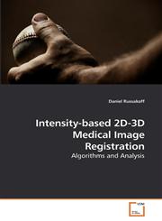 Intensity-based 2D-3D Medical Image Registration,3639119541,9783639119541