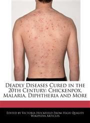 Deadly Diseases Cured in the 20th Century Chickenpox, Malaria, Diphtheria and More,1241183643,9781241183646