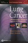 Lung Cancer A Multidisciplinary Approach to Diagnosis and Management,1936287064,9781936287062