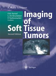 Imaging of Soft Tissue Tumors,3540414053,9783540414056
