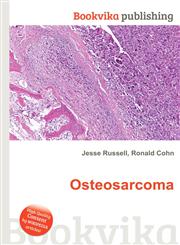 Osteosarcoma,5511238600,9785511238609