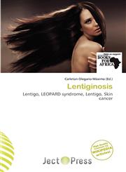 Lentiginosis,6200858918,9786200858917