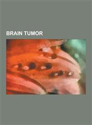Brain Tumor Anaplastic Astrocytoma, Brain Metastasis, Brain Tumour Foundation of Canada, Canine Brain Tumors, Central Neurocytoma,,1230833781,9781230833781