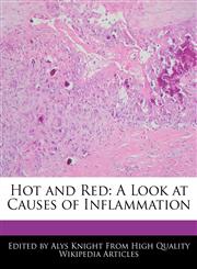 Hot and Red A Look at Causes of Inflammation,1241725136,9781241725136