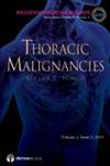Thoracic Malignancies An Issue of Radiation Medicine Rounds,1933864893,9781933864891