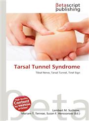 Tarsal Tunnel Syndrome,6136217643,9786136217642