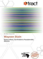 Wayson Stain,6138879635,9786138879633