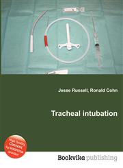 Tracheal Intubation,5510679824,9785510679823