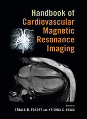 Handbook of Cardiovascular Magnetic Resonance Imaging 1st Edition,0824758412,9780824758417