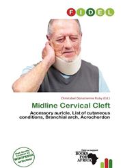 Midline Cervical Cleft,620056759X,9786200567598