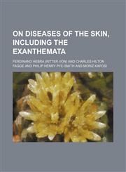On Diseases of the Skin, Including the Exanthemata (Volume 3),115046769X,9781150467691