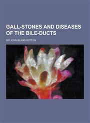 Gall-Stones and Diseases of the Bile-Ducts,1230202277,9781230202273