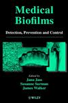 Medical Biofilms Detection, Prevention, and Control,0471988677,9780471988670