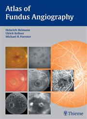 Atlas of Fundus Angiography 1st Edition,3131405511,9783131405517