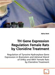 TH Gene Expression Regulation  Female Rats by Clonidine Treatment,3639126769,9783639126761