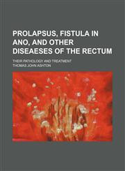 Prolapsus, fistula in ano, and other diseaeses of the rectum; their pathology and treatment,1236440757,9781236440754