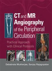 CT and MR Angiography of the Peripheral Circulation Practical Approach with Clinical Protocols 1st Edition,1841846066,9781841846064