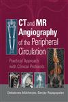 CT and MR Angiography of the Peripheral Circulation Practical Approach with Clinical Protocols 1st Edition,1841846066,9781841846064