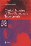 Clinical Imaging in Non-Pulmonary Tuberculosis 1st Edition,3540659404,9783540659402