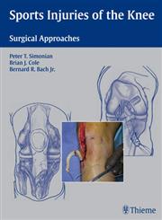 Sports Injuries of the Knee Surgical Approaches 1st Edition,1588903060,9781588903068