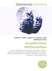 Arnold-Chiari Malformation,6130098111,9786130098117