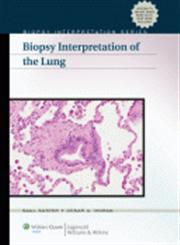 Biopsy Interpretation of the Lung,0781784670,9780781784672