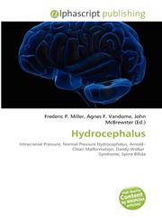 Hydrocephalus,6133861789,9786133861787