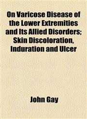 On Varicose Disease of the Lower Extremities and Its Allied Disorders; Skin Discoloration, Induration and Ulcer,1154804216,9781154804218