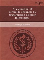 Visualization of ceramide channels by transmission electron microscopy.,1249076072,9781249076070