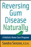 Reversing Gum Disease Naturally A Holistic Home Care Program,0471222305,9780471222309