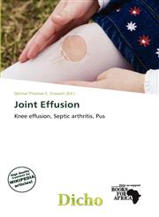 Joint Effusion,6200529485,9786200529480