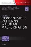 Smith's Recognizable Patterns of Human Malformation Expert Consult - Online and Print 7th Edition,1455738115,9781455738113