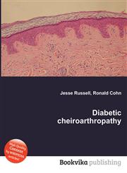 Diabetic Cheiroarthropathy,5512394266,9785512394267