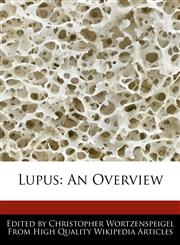 Lupus An Overview,1241728100,9781241728106