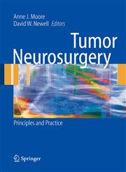 Tumor Neurosurgery Principles and Practice,1846282918,9781846282911