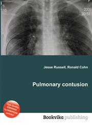 Pulmonary Contusion,5510540346,9785510540345