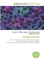 Lung Cancer,6130005385,9786130005382